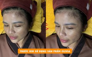 Đại sứ Thương hiệu Nguyễn Thanh Trúc: Hành trình “lột xác” ngoạn mục với làn da rạng rỡ nhờ Olivia